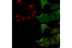 ABIN6262189 and ABIN6266560 staining Hela cells by IF/ICC.