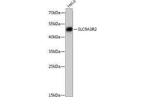 Western blot analysis of extracts of HeLa cells, using SLC9R2 antibody (ABIN7270487) at 1:1000 dilution. (SLC9A3R2 antibody  (AA 180-300))