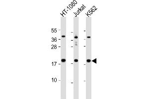 All lanes : Anti-NAT13 Antibody (C-term) at 1:1000 dilution Lane 1: HT-1080 whole cell lysate Lane 2: Jurkat whole cell lysate Lane 3: K562 whole cell lysate Lysates/proteins at 20 μg per lane. (NAA50 antibody  (C-Term))