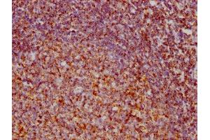 IHC image of ABIN7127868 diluted at 1:73. (Recombinant VDAC1 antibody)
