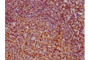 IHC image of ABIN7127868 diluted at 1:73. (Recombinant VDAC1 antibody)