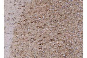 IHC analysis of Integrin beta 4/ITGB4 using anti-Integrin beta 4/ITGB4 antibody (ABIN7600912). (Metabotropic Glutamate Receptor 1 antibody  (AA 25-466))