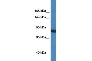 WB Suggested Anti-SEMA4D Antibody Titration: 1.