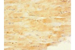 Immunohistochemistry of paraffin-embedded human skeletal muscle tissue using ABIN7165932 at dilution of 1:100 (PPP1R3A antibody  (Regulatory Subunit 3A))