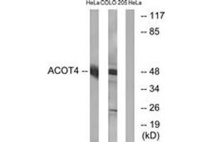 Western Blotting (WB) image for anti-Acyl-CoA Thioesterase 4 (ACOT4) (AA 361-410) antibody (ABIN2890094) (ACOT4 antibody  (AA 361-410))