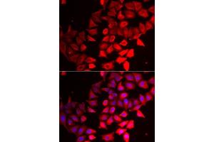 Immunofluorescence analysis of MCF7 cells using CMPK1 antibody. (Cytidine Monophosphate (UMP-CMP) Kinase 1, Cytosolic (CMPK1) (AA 69-228) antibody)