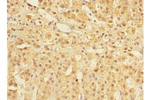 Immunohistochemistry of paraffin-embedded human adrenal gland tissue using ABIN7148298 at dilution of 1:100 (COMMD1 antibody  (AA 1-190))