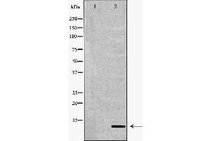 Western blot analysis of A375  lysate using S100B antibody. (S100B antibody  (C-Term))