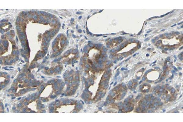 ARHGEF10 antibody  (Internal Region)