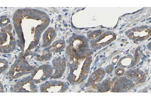 ABIN6275494 at 1/100 staining Human prostate tissue by IHC-P. (ARHGEF10 antibody  (Internal Region))