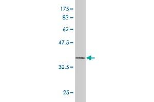 Western Blot detection against Immunogen (37. (PHKB antibody  (AA 984-1093))