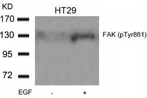Western blot analysis of extracts from HT29 cells untreated or treated with EGF using FAK(Phospho-Tyr861) Antibody. (FAK antibody  (pTyr861))