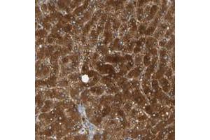 Immunohistochemical staining of human liver with PARP14 polyclonal antibody  shows strong cytoplasmic positivity in hepatocytes at 1:50-1:200 dilution.
