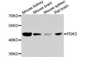 Western blot analysis of extracts of various cell lines, using PDK3 antibody. (PDK3 antibody  (AA 137-406))