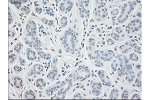 Immunohistochemical staining of paraffin-embedded breast tissue using anti-GAD1 mouse monoclonal antibody. (GAD antibody)