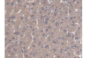 DAB staining on IHC-P; Samples: Human Liver Tissue (ALDH3A1 antibody  (AA 1-311))