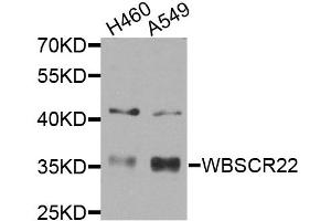 Western blot analysis of extracts of various cell lines, using WBSCR22 antibody (ABIN5974419) at 1/1000 dilution.