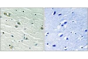 Immunohistochemistry analysis of paraffin-embedded human brain tissue, using MER/SKY (Ab-749/681) Antibody. (MER/SKY (AA 716-765) antibody)