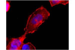 Image no. 1 for anti-Sphingosine-1-Phosphate Receptor 4 (S1PR4) antibody (ABIN201707) (S1PR4 antibody)