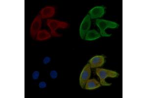 ABIN6260674 and ABIN6269212 staining Hela cells(30 min of UV treatment) by IF/ICC.