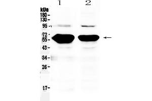 Western blot analysis of Alpha Amylase 1 using anti- Alpha Amylase 1 antibody . (AMY1A, AMY1B, AMY1C (AA 20-50), (N-Term) antibody)