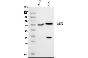Western blot analysis of SMAD2 using anti-SMAD2 antibody (ABIN7602542).
