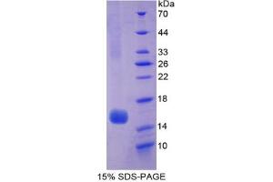 SDS-PAGE analysis of Human Hexosaminidase B beta Protein.