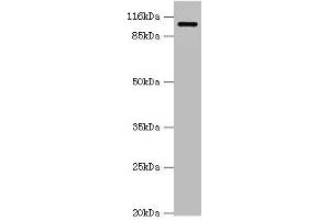 Western blot All lanes: AP2A2 antibody at 0. (AP2A2 antibody  (AA 590-939))