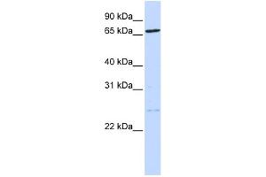 WB Suggested Anti-TLK1 Antibody Titration: 0. (TLK1 antibody  (N-Term))