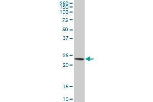 PSMB3 polyclonal antibody (A01), Lot # 051011JC01 Western Blot analysis of PSMB3 expression in HL-60 . (PSMB3 antibody  (AA 106-205))