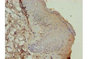 Immunohistochemistry of paraffin-embedded human skin tissue using ABIN7164023 at dilution of 1:100 (ATP12A antibody  (AA 171-306))