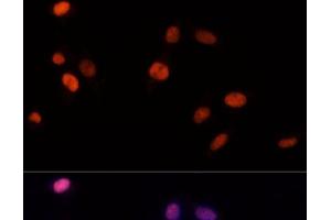 Immunofluorescence analysis of NIH-3T3 cells using PSME3 Polyclonal Antibody at dilution of 1:100 (40x lens). (PSME3 antibody)