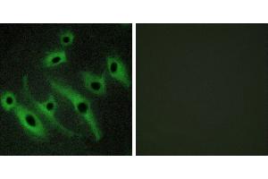 Peptide - +Immunofluorescence analysis of HeLa cells, using HER2 antibody. (ErbB2/Her2 antibody)