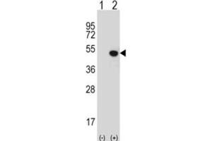 Western Blotting (WB) image for anti-Jumonji Domain Containing 5 (JMJD5) antibody (ABIN2995955)
