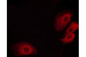 Immunofluorescence (fixed cells) (IF/ICC) image for anti-Platelet/endothelial Cell Adhesion Molecule (PECAM1) (pTyr713) antibody (ABIN6256000)