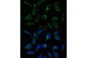 Immunofluorescence analysis of L929 cells using GK2 antibody (ABIN7267458) at dilution of 1:100. (GK2 antibody  (AA 1-150))