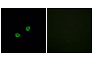 Immunofluorescence analysis of HUVEC cells, using OR1L6 antibody. (OR1L6 antibody  (Internal Region))