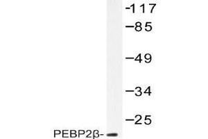 Western blot (WB) analysis of PEBP2beta antibody in extracts from HUVEC