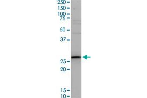 TNNT3 antibody  (AA 161-258)