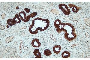 Immunohistochemistry (IHC) image for anti-Prostate Specific Antigen (PSA) (N-Term) antibody (ABIN7598882) (Prostate Specific Antigen antibody  (N-Term))