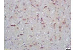 Formalin-fixed and paraffin embedded mouse brain labeled with Rabbit Anti-PKC alpha/beta II (Thr638/641) Polyclonal Antibody, Unconjugated  at 1:200 followed by conjugation to the secondary antibody and DAB staining (PRKCA beta 2 antibody  (pThr638, pThr641))