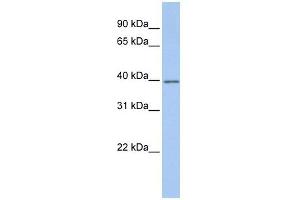 GNAI2 antibody used at 1 ug/ml to detect target protein. (GNAI2 antibody)