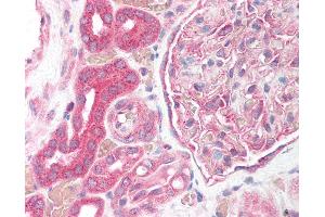 Immunohistochemistry (IHC) image for anti-Hypoxia Inducible Factor 1, alpha Subunit (Basic Helix-Loop-Helix Transcription Factor) (HIF1A) (AA 833-850) antibody (ABIN1901934)