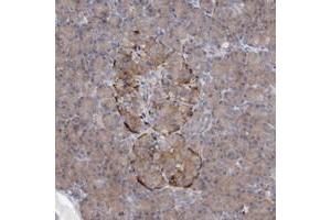 Immunohistochemical staining of human pancreas with AGPS polyclonal antibody  shows strong cytoplasmic positivity in subsets of islet cells at 1:200-1:500 dilution. (AGPS antibody)