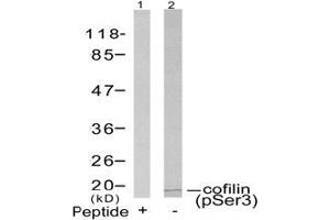 Image no. 3 for anti-Cofilin 1 (CFL1) (pSer3) antibody (ABIN196855) (Cofilin antibody  (pSer3))