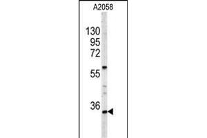 Western blot analysis of HOXA9 Antibody (C-term) (ABIN653066 and ABIN2842667) in  cell line lysates (35 μg/lane). (HOXA9 antibody  (C-Term))