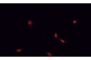 ABIN6268947 staining SHSY5Y? (DREAM antibody  (Internal Region))