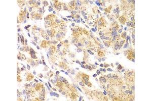 Immunohistochemistry of paraffin-embedded Human stomach using EYA3 Polyclonal Antibody at dilution of 1:100 (40x lens).