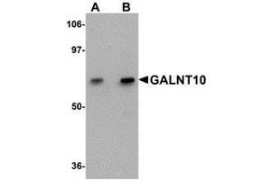 Western blot analysis of GALNT10 in SK-N-SH cell lysate with AP30351PU-N GALNT10 antibody at (A) 1 and (B) 2 μg/ml. (GALNT10 antibody  (C-Term))