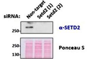 SETD2 polyclonal antibody  (0. (SETD2 antibody  (Internal Region))
